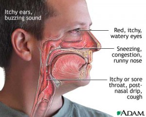 allergy-symptoms