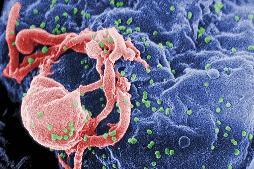 lymphocytes protecting cell from HIV virus