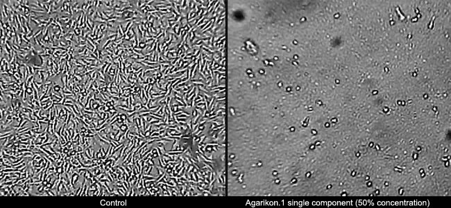Agarikon.1 la componente inibisce fortemente il carcinoma a cellule squamose.